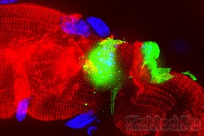 Бактерии умеют перепрограмировать клетки мозго
