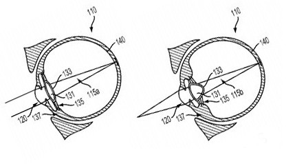 Google получала патент на новое смарт-устройство для глаза