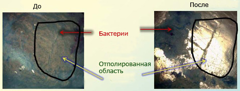 Зубы, Бактерии, Шлифовка