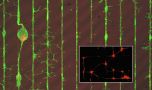 Нейроны будут выращивать на микросхемах