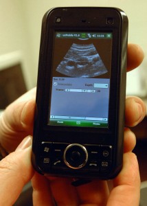 УЗИ, Windows Mobile