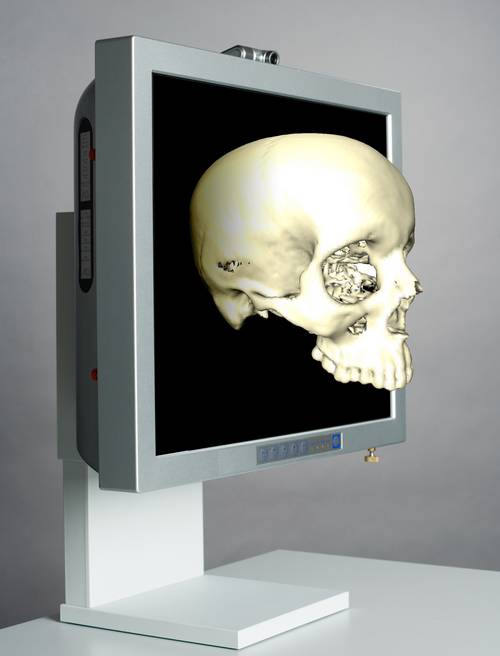 3D-дисплей для хирургов