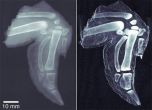 Ученые усовершенствовали рентгеновский аппарат
