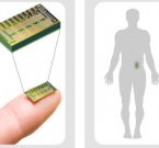 MicroCHIPS испытала на людях чип-имплантат