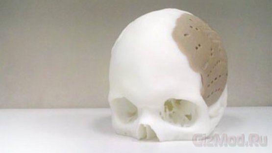 Кости черепа напечатали на 3D-принтере