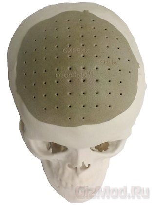 Кости черепа напечатали на 3D-принтере