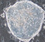 Клетки перепрограммировали в стволовые внутри мыши