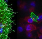 Т-киллеры убивают раковые клетки